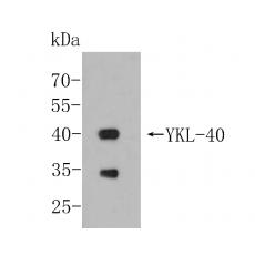 Anti-YKL-40/CHI3L1 antibody [A3G10]
