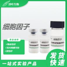 Mouse IL-1RL1 / ST2 Protein, Fc TagMouse IL-1RL1 / ST2 Protein, Fc Tag