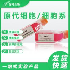 ECV-304+RFP 人脐静脉内皮/人膀胱癌细胞+RFP （红色荧光蛋白标记)  