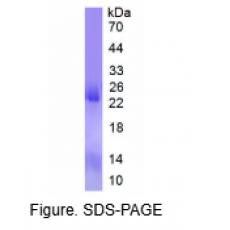 染色质域解旋酶DNA结合蛋白3(CHD3)重组蛋白(Human，人) 